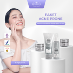 Bening’s Acne Prone – YT